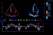 doppler-cardiaco-xs doppler-cardiaco-xs